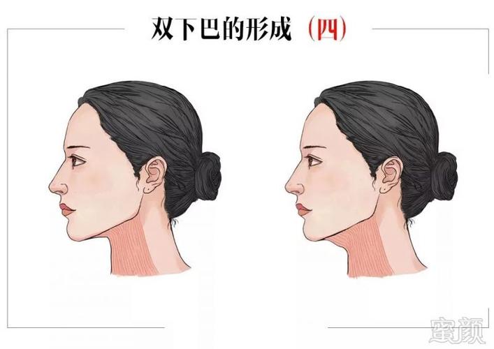 为什么有的人明明很瘦,却有双下巴?