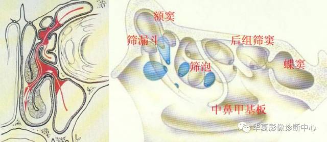 上两图为窦口鼻道复合体解剖图解剖变异主要包括鼻中隔偏曲和嵴突,中