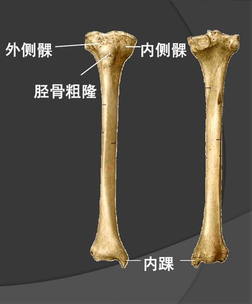胫骨粗隆(正面图)