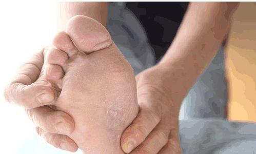 原创当脚出现这4种"信号",要当心是早期糖尿病,及时检查控制