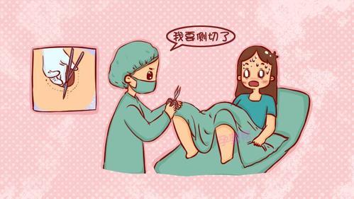 告诉你无侧切顺产的秘诀