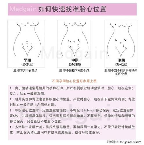 如何找准胎心位置?