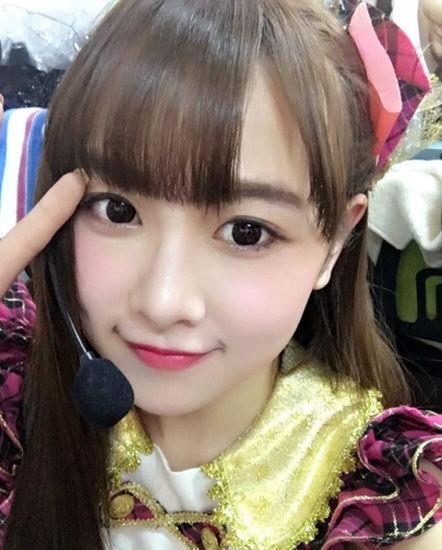 唐安琪烧伤后续 费玉清捐款snh48成员义演