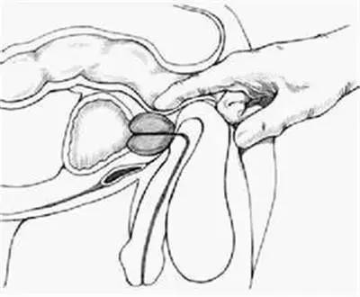 直肠指检不可忽视的一指神功