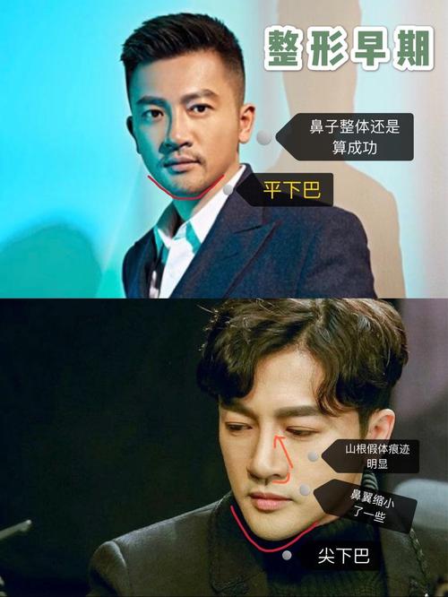 惊!苏有朋的鼻子怎么变成了这样