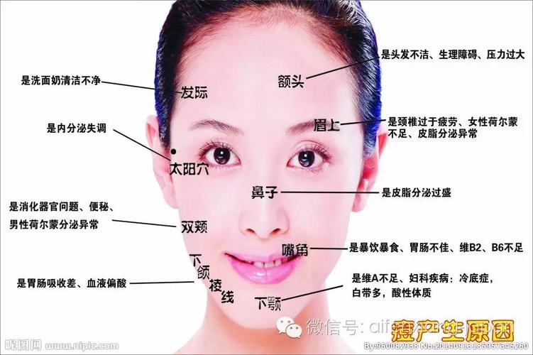 那我们来看看面部痘痘的成因分析图吧 各位看官,请看清楚自己长痘痘
