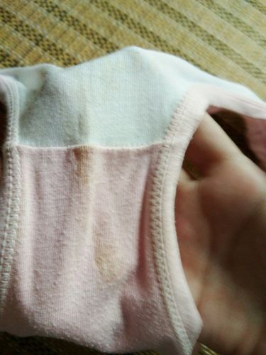 9岁女童内裤上有一点淡黄色的东西,有一点硬.