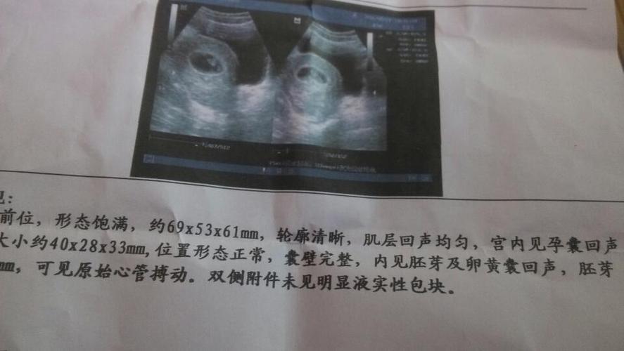 帮忙看下孕囊是圆形还是长形的,那个数据是孕囊的?谢谢!