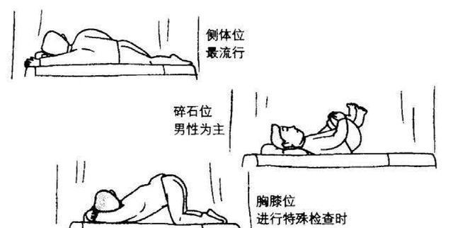 痔疮检查姿势大盘点!收藏备用!转发分享!