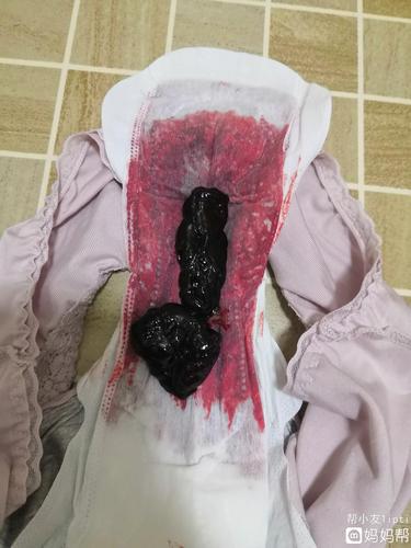 *猜你喜欢* #大出血##褐色分泌物何时是个头# 从五周开始发现有小量