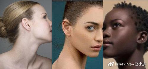 不同人种的肤色基因