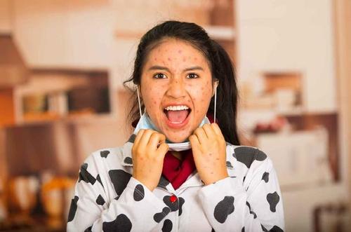 连圈状秕糠疹发病部位是皮肤有遗传性部分病例可呈家族性发病