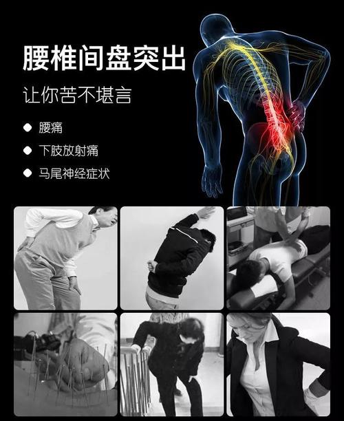 颈腰椎疼痛苦不堪言,10年腰突患者从绝望到遇见希望
