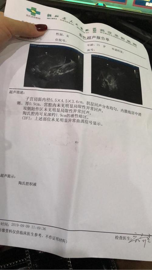 盆腔积液可以怀孕吗