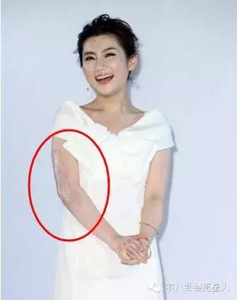 小8也发现网络上流传了很多唐安琪的烧伤图,然而都是假的!