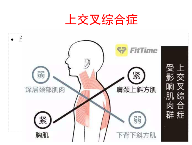 下交叉综合征是由骨盆周边肌肉力量不平衡而导致一系列综合症候群