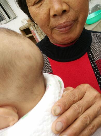 儿子快5个月了,后脑勺这样一个大包,怎么办?