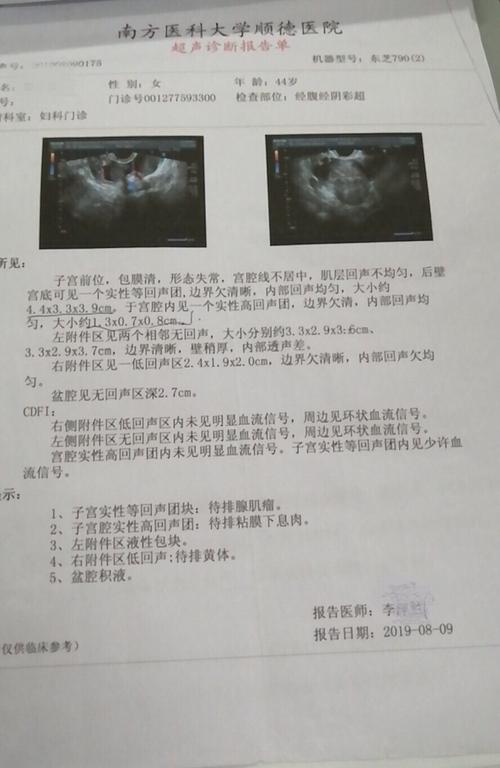 "一箭双雕"——南人医妇科 腹腔镜下切除残角子宫及单