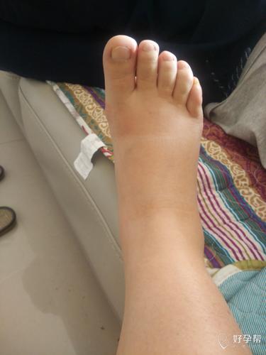 孕37周……我的肿肿的脚和大胖腿