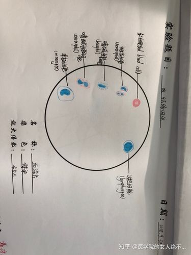 有没有红蓝铅笔血涂片的手绘图