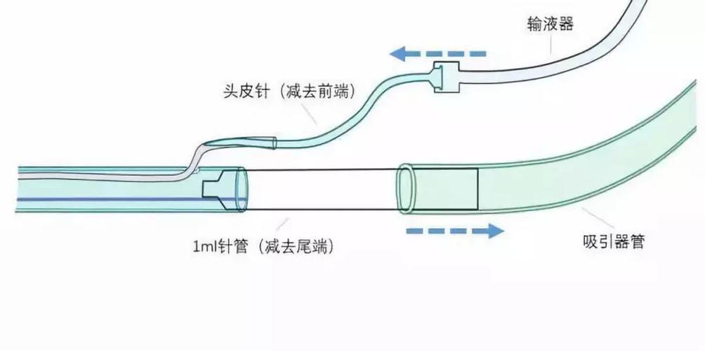 画说引流管:教你轻松搞定腹腔冲洗
