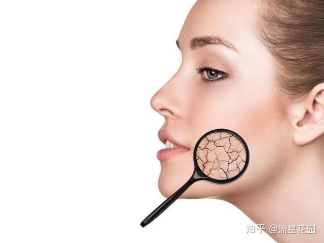 干性肌肤易缺水皮肤干燥