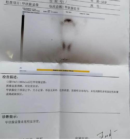 甲状腺结节也可以标体承保的医疗险