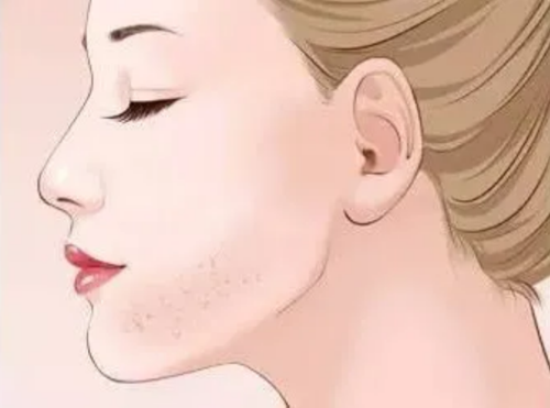 脸上长斑怎么办?教你三招,赶紧看看!