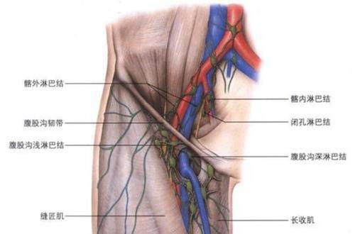股沟淋巴出现堵塞时,你可以用手擦腹股沟时,内部感觉到疼痛和股沟结洁
