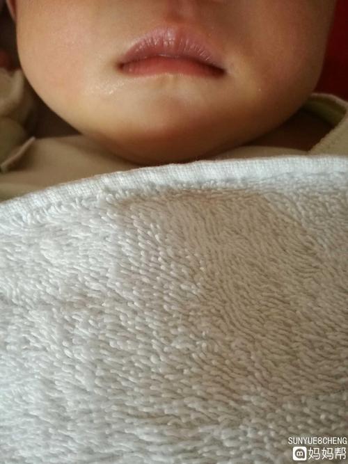 新生儿嘴唇