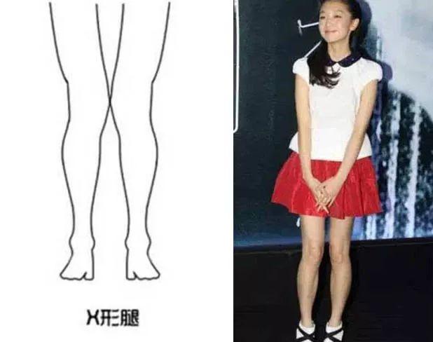 杨幂,林志玲都有的腿型问题,全靠这样藏起来!
