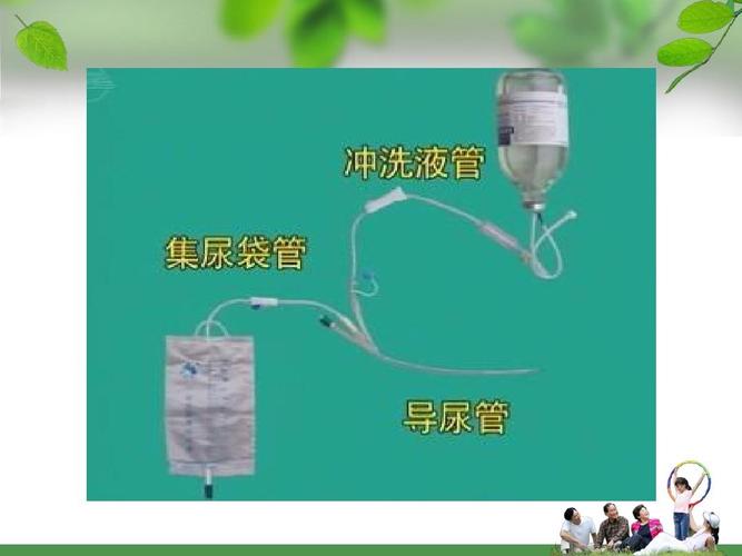 膀胱冲洗的护理ppt