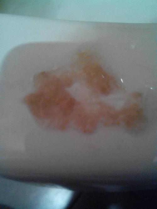 肺结核?慢性咽炎?我每天都会吐很多痰