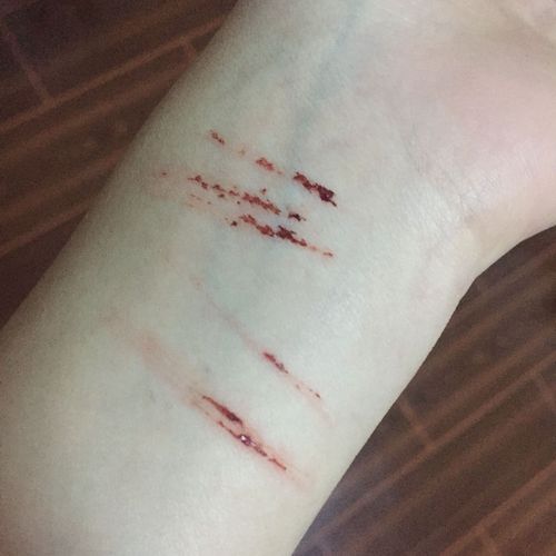 用眉刀割的手腕,伤口多久愈合