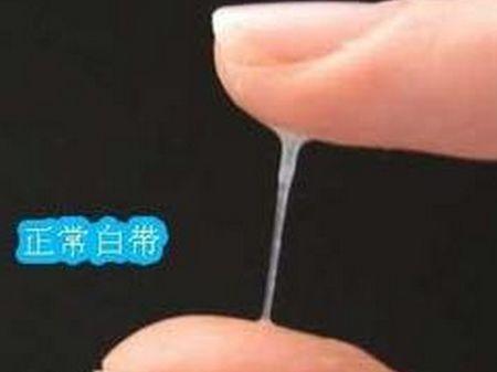 白带异常|白带|黑米_新浪新闻
