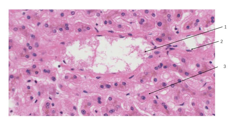 在肝小叶内,中央静脉和肝血窦是相通的.