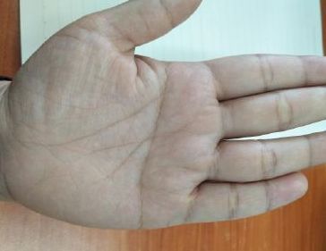 事业线上横纹,而且是位于月丘的位置,不注重现实,喜欢幻想,感情丰富