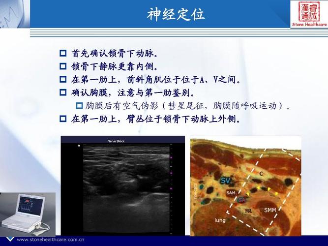 所有分类 自然科学 生物学 超声引导在麻醉领域的应用ppt  神经定位