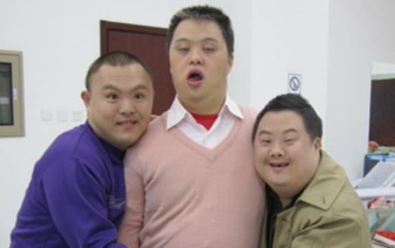 可能有很多人并不太清楚,其实唐氏综合征是具有一定的遗传性的,如果