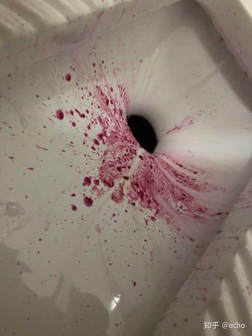 为什么早上吃的红心火龙果晚上就拉红色的大便了?