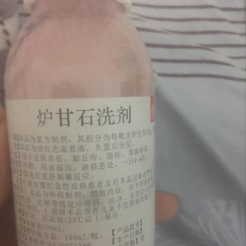 怀孕三个月了,下巴两边的脸长大红色的痘痘,又痛又痒,可以涂炉甘石