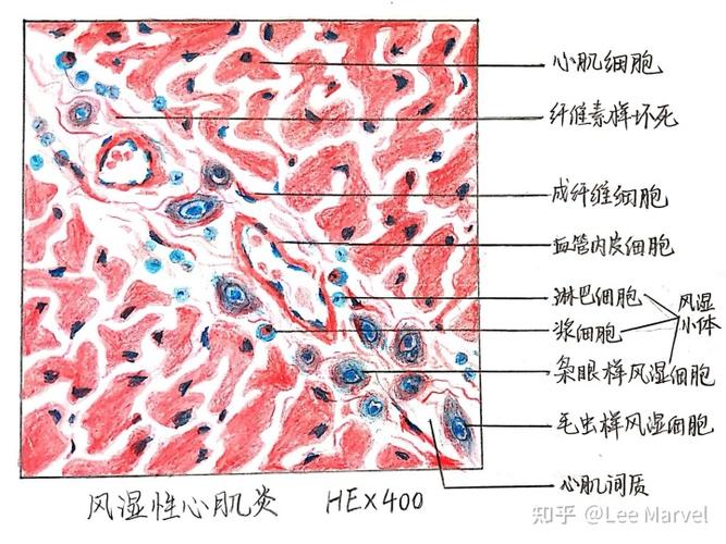 大学病理学红蓝铅笔绘图