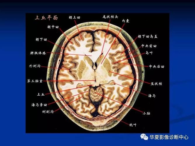 影像回顾头颅基本断层解剖