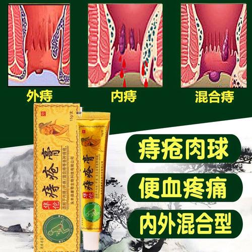 华佗痔疮药膏治便血止痛止痒特效消肉球内痔外痔混合痔化痔痔疮膏