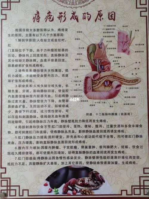痔疮成因,防范于未然_痔疮_安宁市中医医院(康云路)自由行热门攻略