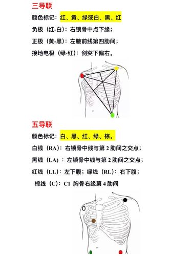 心电图各导联安装部位示意图护士必记