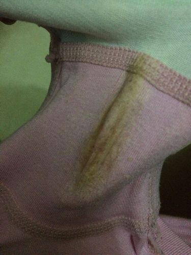 白带这样子正常吗?