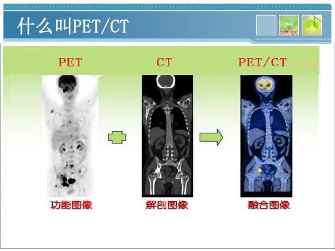 pet-ct 检查的临床应用(1.15)ppt