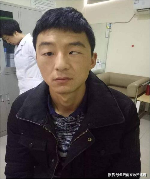 {昆明小儿推拿培训}分享儿童斜视推拿手法