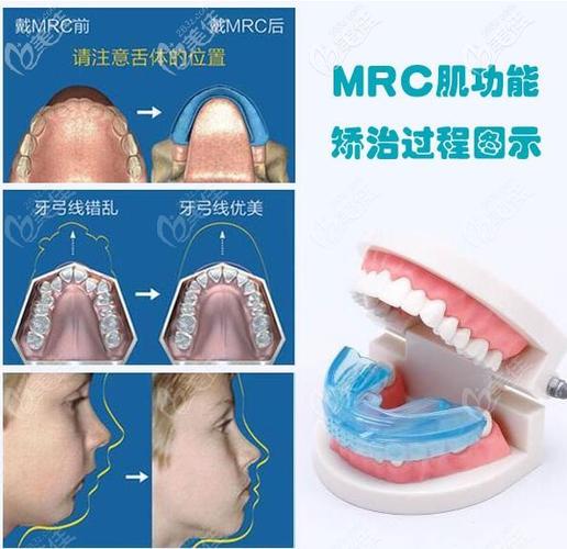 从mrc牙齿矫正器的利弊来分析为什么儿童mrc矫正器争议大,还有人说是